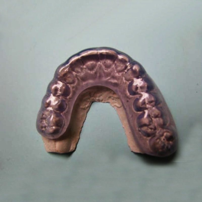 Férula oclusal