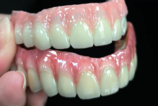 ¿Cómo lidiar con los dientes amarillos?