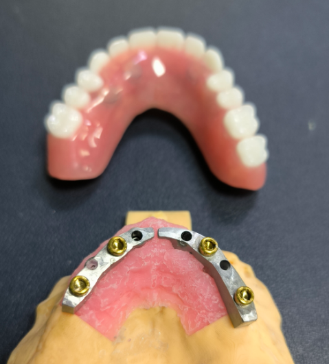 Localizador y barra dental de titanio
