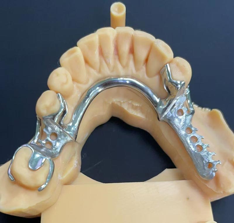 Ventajas de la estructura de cobalto-cromo (estructura Co Cr)