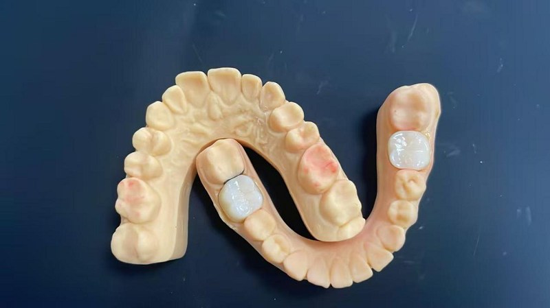 ¿Cuál es el borde del hombro?