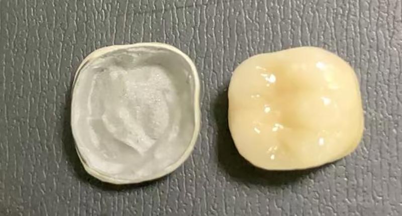 WM DENTAL LAB: un laboratorio dental líder en China