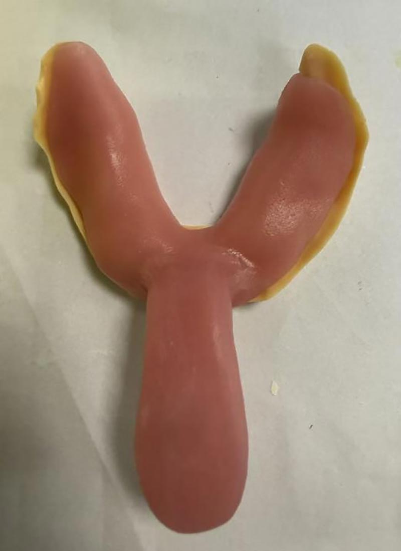 Cosas que no sabías sobre las bandejas dentales personalizadas