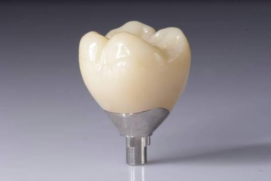 Optimice sus resultados con restauraciones de circonio (coronas, puentes, implantes)
