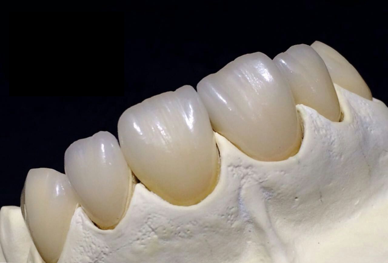 Laboratorio dental Full Zirconia Crown China