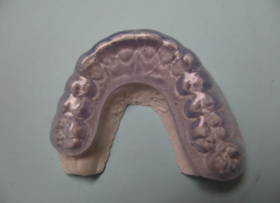 Soporte oclusal